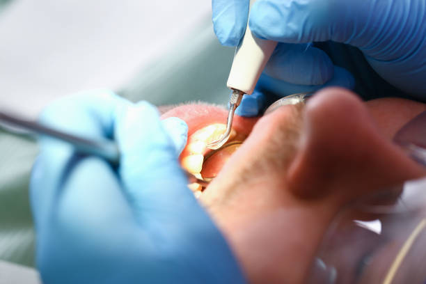 Best Orthodontic Emergency Dentist in Pantego, TX